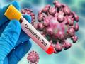 CoronaVirus : कोरोनापासून बचावासाठी फक्त एकच मार्ग, आपोआपच कमी होतील रुग्ण - Marathi News | CoronaVirus : Avoid to touch these things during corona virus lockdown myb | Latest health Photos at Lokmat.com