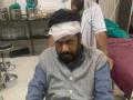 बच्चू कडूंना पुढील उपचाराकरिता नागपूरला हलवले - Marathi News | Bachu Kadu was shifted to Nagpur for further treatment | Latest nagpur News at Lokmat.com