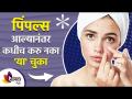 पिंपल्स आल्यानंतर कधीच करु नका 'या' चुका | Avoid these Mistakes to Get Rid of Pimples Lokmat sakhi - Marathi News | Never make 'these' mistakes when pimples appear Avoid these Mistakes to Get Rid of Pimples Lokmat sakhi | Latest sakhi Videos at Lokmat.com