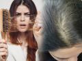 Hair Care Tips : केस विंचरताना कंगव्यात केसांचा मोठा पुंजका येतो? केस खूप गळत असतील तर करा 5 उपाय - Marathi News | Hair Care Tips : If the hair is falling out a lot, do 5 remedies | Latest sakhi News at Lokmat.com
