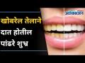 खोबरेल तेलाने दात होतील पांढरे शुभ्र | Natural Ways to Whiten Your Teeth I Lokmat Oxygen - Marathi News | Coconut oil will whiten teeth Natural Ways to Whiten Your Teeth I Lokmat Oxygen | Latest oxygen Videos at Lokmat.com