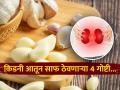 किडनी डिटॉक्ससाठी महत्वाचे ४ पदार्थ, तब्येत सांभाळायची तर आहार चुकवू नका - Marathi News | These 4 foods keep the kidneys clean from inside | Latest sakhi News at Lokmat.com