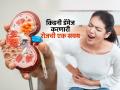 रोजची 'ही' एक सवय किडनीला करत आहे डॅमेज, आपल्यालाही असेल तर लगेच सोडा आणि जीव वाचवा! - Marathi News | Kidney Damage Cause : This one daily diet habit is damaging your kidney | Latest sakhi News at Lokmat.com