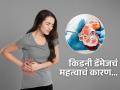 जास्त प्रमाणात प्रोटीन घेणं घातक, किडनी होऊ शकते डॅमेज; पाहा कुणाला असतो जास्त धोका - Marathi News | High protein diet can damage your kidneys says study | Latest sakhi News at Lokmat.com