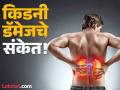 किडनी डॅमेज होत असेल तर रात्री दिसतात ही लक्षणं, दुर्लक्ष कराल तर पडू शकतं महागात! - Marathi News | Kidney disease symptoms : These symptoms seen at night indicate kidney damage | Latest health News at Lokmat.com