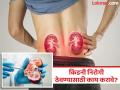चाळिशीनंतर वाढतो किडनी आजारांचा धोका, पाहा किडनींची काळजी कशी घ्याल आणि ठेवाल मजबूत.... - Marathi News | What are kidney care tips and signs of kidney damage kidney | Latest health News at Lokmat.com