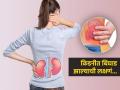 World Kidney Day 2026 : किडनीत बिघाड झाल्यास सगळ्यात आधी कुठे दुखायला लागतं, पाहा नेमकी लक्षणं - Marathi News | Where kidney problem pain occurs and which symptoms are seen | Latest sakhi News at Lokmat.com
