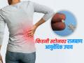 असह्य वेदना, लघवी करताना जळजळ होते? २ नॅचरल उपाय, किडनी स्टोनचा त्रास होतो कमी - Marathi News | Ayurvedic expert tells about 2 home remedies for prevent kidney stone pain | Latest sakhi News at Lokmat.com