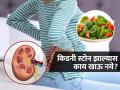 किडनी स्टोन झाल्यास पालक आणि टोमॅटो एकत्र खाणं घातक,आहारतज्ज्ञ सांगतात एक महत्वाचा नियम - Marathi News | If you have kidney stones avoid the combination of spinach and tomatoes, know why | Latest sakhi News at Lokmat.com