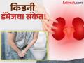 सकाळी लघवीचा रंग 'असा' दिसेल तर वेळीच व्हा सावध, आतल्या आत डॅमेज होऊ शकतात किडनी! - Marathi News | Change in urine color can be kidney damage symptoms | Latest health News at Lokmat.com