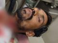 नायलॉन मांजामुळे कापला मजुराचा गळा; लागले ५० टाके - Marathi News | A laborer's throat was cut by a nylon manja; It took 50 stitches | Latest nagpur News at Lokmat.com