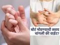बोटं मोडल्याने हाडं कमजोर होतात किंवा काही समस्या होतात का? पाहा काय सांगतं संशोधन - Marathi News | What happens when you crack your knuckles know facts and myth | Latest sakhi News at Lokmat.com