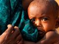 रत्नागिरी जिल्ह्यात २२ तीव्र कुपोषित बालके - Marathi News | 22 severely malnourished children in Ratnagiri district | Latest ratnagiri News at Lokmat.com