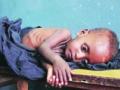 जिल्ह्यात तीन वर्षात 2700 बालकांचा मृत्यू - Marathi News | 2700 children die in the district in three years | Latest nandurbar News at Lokmat.com