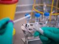 कोरोना चाचण्यासाठी बुलडाण्यातील प्रयोग शाळेस मान्यता - Marathi News | Buldana lab approval for corona testing | Latest buldhana News at Lokmat.com