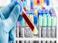 CoronaVirus : कोरोना चाचणीच्या ६० लॅब होणार- वैद्यकीय शिक्षणमंत्री देशमुख - Marathi News | There will be 60 corona test labs: Medical Education Minister Deshmukh | Latest latur News at Lokmat.com