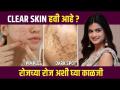 Clear स्किनसाठी सोपं Routine | How to Get Clear Skin Naturally | Skincare tips | Lokmat Sakhi - Marathi News | Simple Routine for Clear Skin | How to Get Clear Skin Naturally | Skin care tips Lokmat Sakhi | Latest sakhi Videos at Lokmat.com