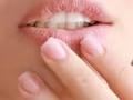 हिवाळ्यात ओठ फाटू नये, कोरडे पडू नये म्हणून काय करावं? करा 'हे' सोपे, मग बघा कमाल... - Marathi News | Best home remedies for dry skin cheeks and lips in winter | Latest sakhi News at Lokmat.com
