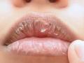 थंडीत ओठ फुटणारच पण रक्त येऊन जखम होऊ नये म्हणून टाळा 'या' चुका, ओठ राहतील मऊ गुलाबी - Marathi News | Lips will crack in the cold, but avoid these mistakes to prevent bleeding, your lips will remain soft and pink. | Latest sakhi News at Lokmat.com