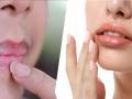 Beauty Tips: वरचा ओठ जास्त काळा पडलाय? हे घरगुती उपाय करा, काळपटपणा कमी होतो! - Marathi News | Beauty tips: Home remedies for the pigmentation or darkness on upper lip... | Latest sakhi News at Lokmat.com