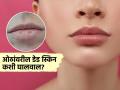 साखर-मधाचा करा सोपा उपाय-तुमचेही ओठ दिसतील गुलाबी मऊ, डेडस्किन गायब-दिसाल सुंदर - Marathi News | How to use Sugar and honey to get rid of dead skin from lips and restore natural softness | Latest sakhi News at Lokmat.com