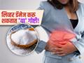 World Liver Day 2025 : आपण रोज खातो 'या' गोष्टी, मात्र त्याच करत आहेत लिव्हर डॅमेज - Marathi News | World Liver Day 2025 : daily foods which can damage your liver | Latest sakhi News at Lokmat.com