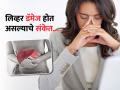 World Liver Day 2025 : सतत थकवा, पिवळसर डोळे, लिव्हरमध्ये तर गडबड नाही? लक्षणांकडे दुर्लक्ष करणं पडेल महागात - Marathi News | Liver Health : Symptoms indicating that your liver health is in danger | Latest sakhi News at Lokmat.com