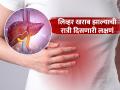 रात्री दिसणारी 'ही' ५ लक्षणं सांगतात लिव्हरच्या आजाराचा धोका, वेळीच ओळखा आणि जीव वाचवा! - Marathi News | These 5 symptoms seen at night may be of liver disease | Latest sakhi News at Lokmat.com