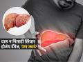 दारू न पिताही अनेकांचं लिव्हर होतंय डॅमेज, पाहा रोजच्या कोणत्या सवयी पडताहेत महागात - Marathi News | Liver cirrhosis rising without alcohol doctors warn, know its symptoms and causes | Latest health News at Lokmat.com