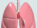 फुफ्फुसाच्या कॅन्सरमध्ये राज्यात नागपूर दुसरे - Marathi News | Nagpur second in the state of lung cancer | Latest nagpur News at Lokmat.com