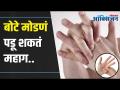 Cracking Your Knuckles | तुम्हाला बोटे मोडायची सवय आहे का? पडू शकते महागात | Lokmat Oxygen - Marathi News | Cracking Your Knuckles | Do you have a habit of breaking fingers? Can be expensive | Lokmat Oxygen | Latest health Videos at Lokmat.com