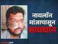 नायलाॅन मांजाने तरुणाचा डोळा थोडक्यात बचावला, अन्य एकाचा कान तर दुसऱ्याचा गळा कापला - Marathi News | Nylon manja cuts chick young man narrowly escapes eye, cuts off ear of another and throat of another | Latest chhatrapati-sambhajinagar News at Lokmat.com