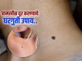 महागडी ट्रीटमेंट कशाला, 'या' घरगुती उपायांनीही कमी होतील त्वचेवरील चामखीळ - Marathi News | Home remedies to remove mole from skin | Latest sakhi News at Lokmat.com