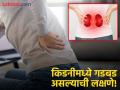 किडनी खराब झाल्यावर सकाळी दिसतात 'ही' ५ लक्षणं, दुर्लक्ष करणं पडू शकतं महागात! - Marathi News | 5 symptoms of kidney problem appear in the morning | Latest health News at Lokmat.com