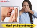 तोंडाच्या दुर्गंधीमुळे चारचौघात होतो इज्जतीचा फालूदा, जाणून घ्या यामागची कारणं! - Marathi News | Bad breath can ruin your reputation, know the reasons behind it! | Latest health Photos at Lokmat.com
