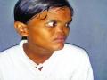 ५०० वर्षांपूर्वीच्या तंत्राने मिळाले नवे नाक, नगरच्या तरुणीवर दुर्मीळ शस्त्रक्रिया यशस्वी - Marathi News | A new nose, a 500-year-old technique, has a rare operation on the girl's girl | Latest maharashtra News at Lokmat.com
