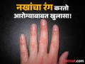 नखांचा रंग आणि आकारावरून होतो आरोग्याचा खुलासा, जाणून घ्या काही गंभीर संकेत! - Marathi News | Structure and color of nails reveal the secret of your health | Latest health Photos at Lokmat.com