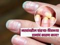 नखांवर पांढरे डाग-लांब रेषा दिसतात? शरीरात ‘या’ व्हिटामिन्सची कमतरता, मोठे आजार होण्याचा धोका - Marathi News | What Fingernails and Toenails Color Or Changes Say About Your Health | Latest sakhi News at Lokmat.com