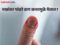 अनेकांच्या नखांवर पांढरे डाग कशाचे असतात? पाहिले तर असतील पण माहीत नसेल कारण - Marathi News | Why do white marks appear on our nails, know the reason | Latest jarahatke News at Lokmat.com