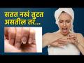 तुटणाऱ्या नखांसाठी वापरा या सोप्या टिप्स | Nail Care Tips Every One Should Know | Fix Broken Nail - Marathi News | Use these simple tips for brittle nails Nail Care Tips Every One Should Know | Fix Broken Nail | Latest beauty Videos at Lokmat.com