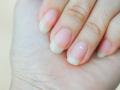नखांवर पांढरे डाग का येतात ? जाणून घ्या... - Marathi News | why-do-white-spots-appear-on-nails | Latest health News at Lokmat.com
