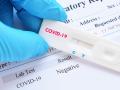 CoronaVirus in Nagpur : नागपुरात बाधितांपेक्षा कोरोनामुक्तांची संख्या अधिक - Marathi News | Corona Virus in Nagpur: More coronaviruses than infected in Nagpur | Latest nagpur News at Lokmat.com