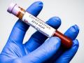 CoronaVirus in Nagpur : ९४४३ चाचण्यांतून ७२५ पॉझिटिव्ह - Marathi News | CoronaVirus in Nagpur: 725 positive out of 9443 tests | Latest nagpur News at Lokmat.com
