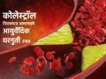 Health Tips: आता कोलेस्ट्रॉलची काळजी नको; करा 'हे' पाच सोपे घरगुती उपाय! - Marathi News | Health Tips: Don't worry about cholesterol anymore; Do 'these' five simple home remedies! | Latest health Photos at Lokmat.com