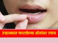 Health Tips: उन्हाळ्यात ओठ फुटण्यामागचे कारण आणि त्यावर उपाय काय? जाणून घ्या! - Marathi News | Health Tips: What are the causes and remedies for chapped lips in summer? Find out! | Latest health Photos at Lokmat.com