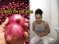 उन्हाळ्यात हमखास होतो पोटात बिघाड; रोज एक कच्चा कांदा उन्हाळ्यात खाण्याचा पाहा सोपा उपाय - Marathi News | Health Tips: Stomach upset is a must in summer; one raw onion every day is the panacea! | Latest sakhi News at Lokmat.com