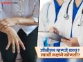 GBS Disease: जीबीएस आजाराबाबत मार्गदर्शक सूचना जारी! जाणून घ्या, काय करावं अन् काय टाळावं - Marathi News | Guidelines issued regarding GBS disease! Know what to do and what to avoid | Latest pune News at Lokmat.com