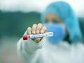 CoronaVirus News : बापरे! खूप काळजी घेतली तरी झाली कोरोनाची लागण?, डॉक्टरांनी सांगितलं महत्त्वाचं कारण - Marathi News | CoronaVirus Marathi News despite all precautions you victim of corona big reason | Latest national News at Lokmat.com