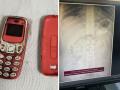 काय सांगता! व्यक्तीने गिळला पूर्ण नोकिया ३३१० फोन आणि मग.... - Marathi News | a man swallows entire nokia 3310 phone than happen | Latest jarahatke News at Lokmat.com