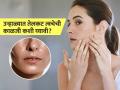 महागडे प्रॉडक्ट्स विसरा, उन्हाळ्यात तेलकट त्वचेसाठी 'हे' नॅचरल उपाय ठरतील बेस्ट; घामाचा त्रासही होणार नाही - Marathi News | Natural and home remedy to take care of oily skin in summer | Latest sakhi News at Lokmat.com
